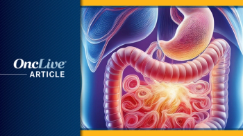 HER2-Negative Gastric Cancer  | Image Credit: © Ashling  Wahner & MJH Life Sciences  Using AI