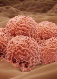 Adjuvant Encorafenib/Binimetinib in BRAF V600–Mutant Melanoma | Image Credit: © Artur - stock.adobe.com