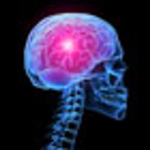 The Role of Radiation in the Management of Brain Metastases