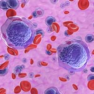 KIT Inhibitors Lead to Shift in Treatment of Systemic Mastocytosis