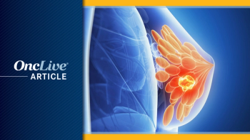 Breast Cancer | Image Credit: Sebastian Kaulitzki - stock.adobe.com