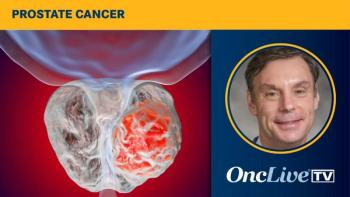 Radioligand Therapy in Prostate Cancer Management | Image Credit: © Dr_Microbe - stock.adobe.com