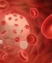 Systemic Mastocytosis
