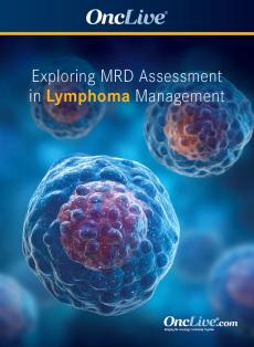 Exploring MRD Assessment in Lymphoma Management