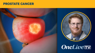 EMBARK Trial in Prostate Cancer | Image Credit: © Sebastian Kaulitzki - stock.adobe.com