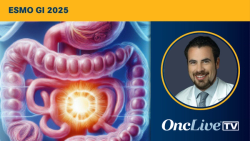 Dr Weinberg on the Rationale for Combining BXCL701 With Pembrolizumab in mPDAC