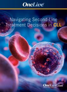 Navigating Second-Line Treatment Decisions in CLL