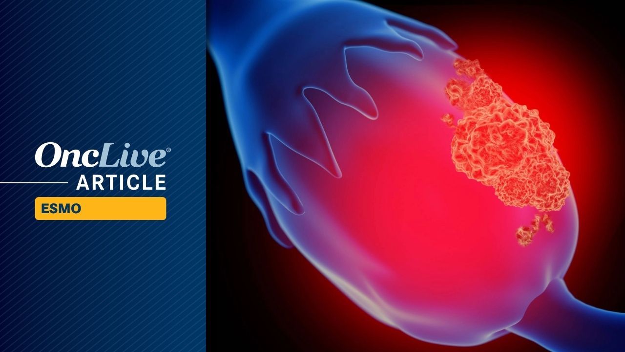 INCB123667 Plus Bevacizumab in Platinum-Resistant Ovarian Cancer