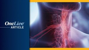 Thyroid Cancer | Image Credit: © Creative Station - stock.adobe.com