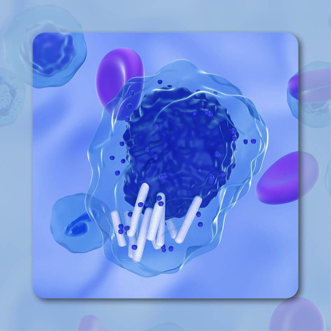 Chronic Lymphocytic Leukemia | Image Credit: © LAZLO- stock.adobe.com