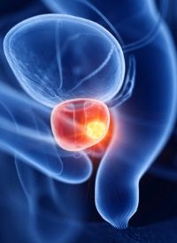 Prostate cancer | Image Credit:   Sebastian Kaulitzki © stock.adobe.com