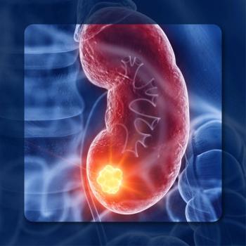 RCC | Image Credit: © Sebastian Kaulitzki – stock.adobe.com