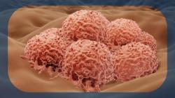 Bocodepsin/Binimetinib Is Tolerable, Shows Combinatorial Activity in NRAS-Mutant Metastatic Melanoma