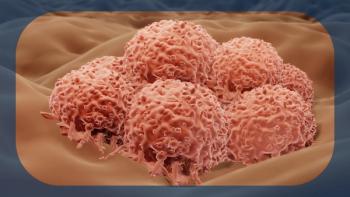 Melanoma | Image credit:  © Artur - stock.adobe.com