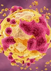 melanoma, head and neck cancer