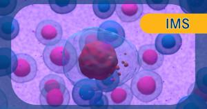 Isa-VRd in multiple myeloma:  © vitanovski - stock.adobe.com