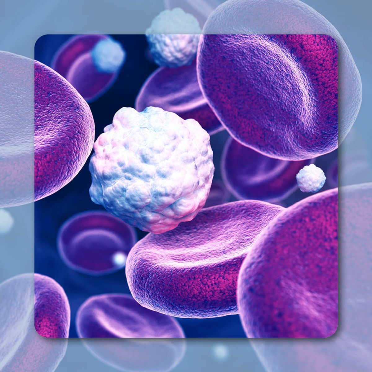 Mantle cell lymphoma | Image Credit: © Tatiana Shepeleva – stock.adobe.com
