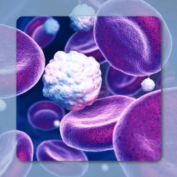 Transposon-Based BAFF CAR T Cells Show Early Efficacy, Safety in R/R Non-Hodgkin Lymphoma