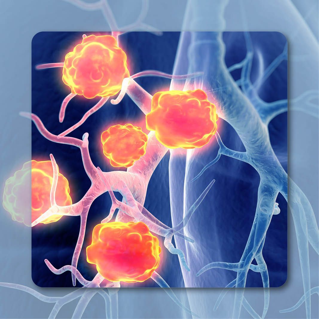 Savolitinib Plus Osimertinib for Pretreated EGFR+ NSCLC | Image Credit: © Axel Kock – stock.adobe.com