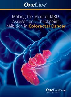 Making the Most of MRD Assessment, Checkpoint Inhibition in Colorectal Cancer