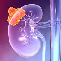Renal Cell Carcinoma - stock.adobe.com