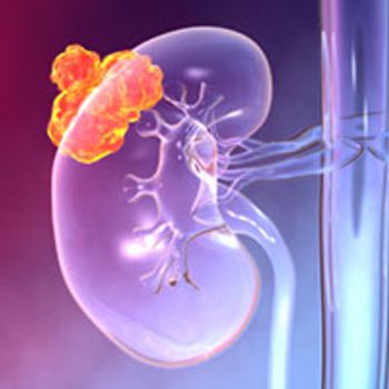 Renal Cell Carcinoma - stock.adobe.com