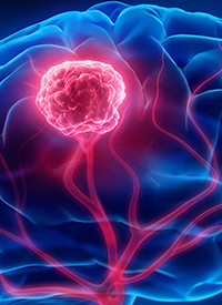 Novel Immunotherapy SurVaxM in Glioblastoma | Image Credit: © peterschreiber.media – stock.adobe.com