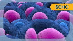 Peak CAR T-Cell Expansion Associated With Reduced Relapse Risk Following Brexu-Cel Consolidation in B-ALL