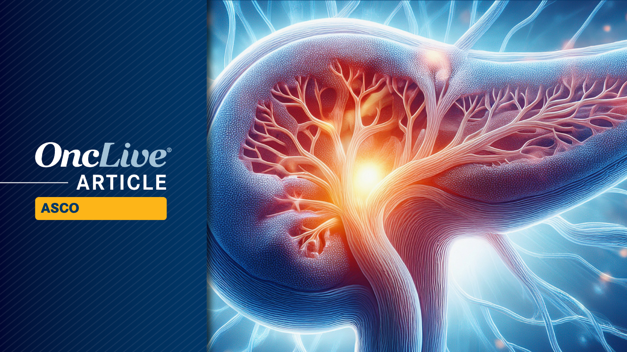Daraxonrasib Meets All Primary, Key Secondary Efficacy End Points in Pretreated PDAC