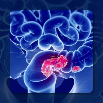 CRC | © Anatomy Insider – stock.adobe.com