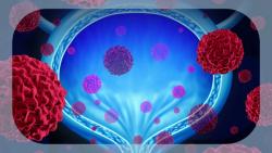 FDA Grants Priority Review to TAR-200 for BCG-Unresponsive High-Risk NMIBC