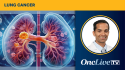 Dr Sampath on the Safety of Consolidative Radiotherapy Plus Osimertinib in Advanced EGFR-Mutant NSCLC