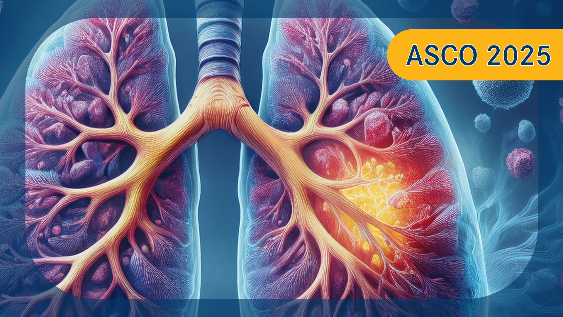 健康・医学 A Cancer Survivor's Almanac Randomized, open-label, phase 2 study of andecaliximab plus