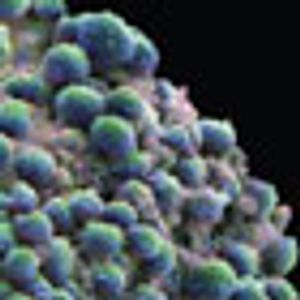 Predicting Prostate Outcomes: Nomograms Help Patients Sort Options, But Caution Is Urged