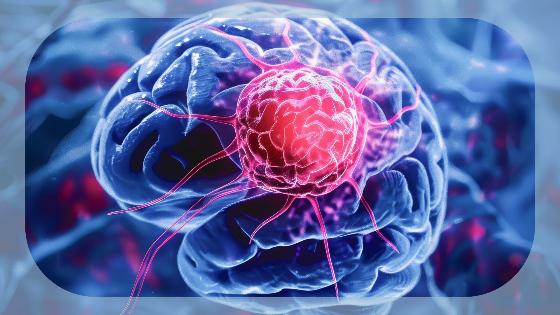 H3K27M-Mutant Diffuse High-Grade Glioma | Image Credit: © iDoPixBox - stock.adobe.com