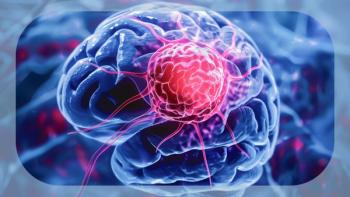MB-101 for Astrocytoma and Glioblastoma | Image Credit: © iDoPixBox - stock.adobe.com