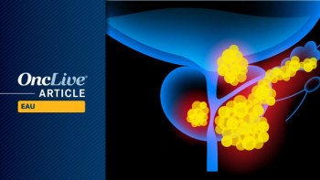 Early-Stage Prostate Cancer | Image Credit: © pikovit - stock.adobe.com