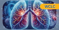 SHR-4849 Shows Activity With Manageable Safety in Relapsed Small Cell Lung Cancer
