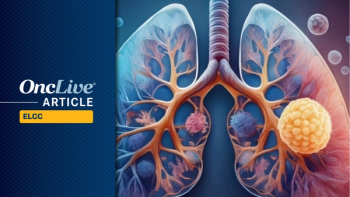 EGFR-Mutated NSCLC | Image Credit: © Image by Ashling Wahner & MJH Life Sciences Using AI