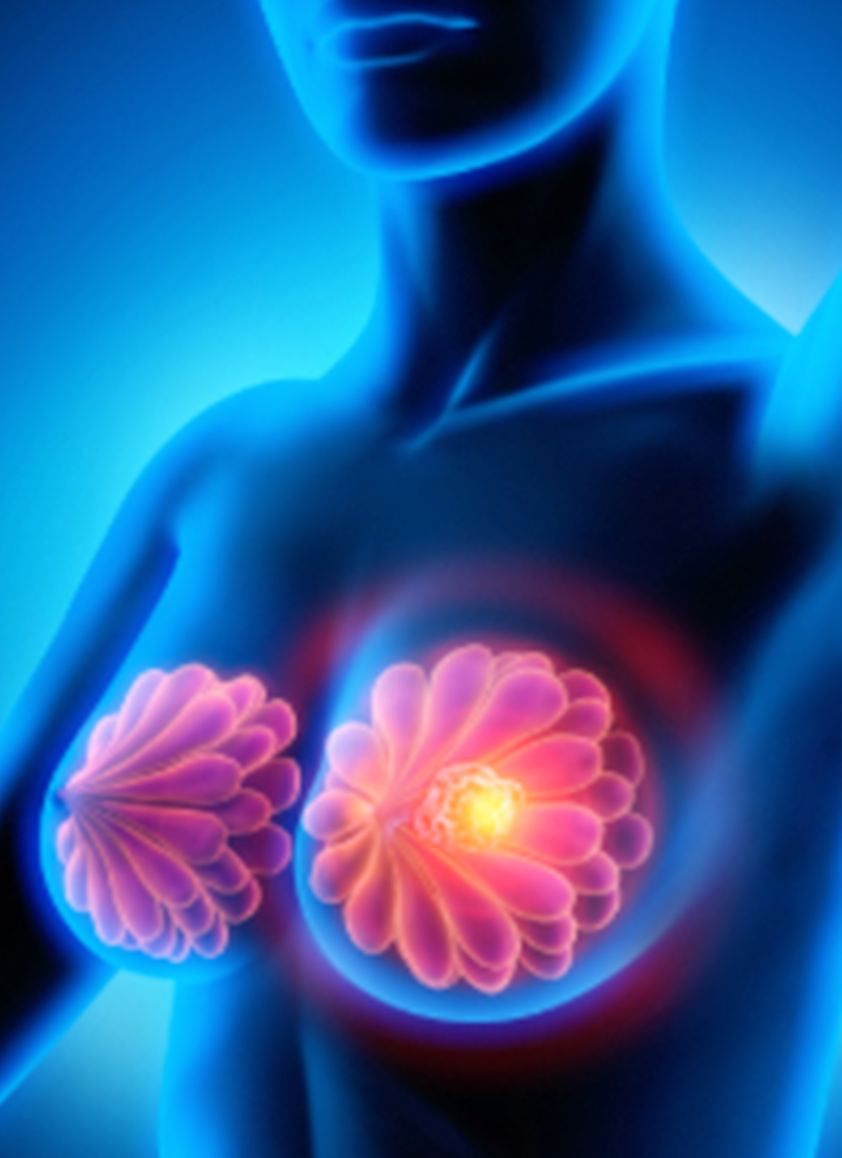 China Approves Dato Dxd as a Breakthrough for Previously Treated Hr Positive Her2 Negative Metastatic Breast Cancer