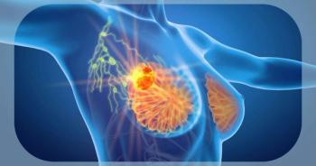 Fox Chase Cancer Center Breast Program | Image Credit: © Axel Kock - stock.adobe.com