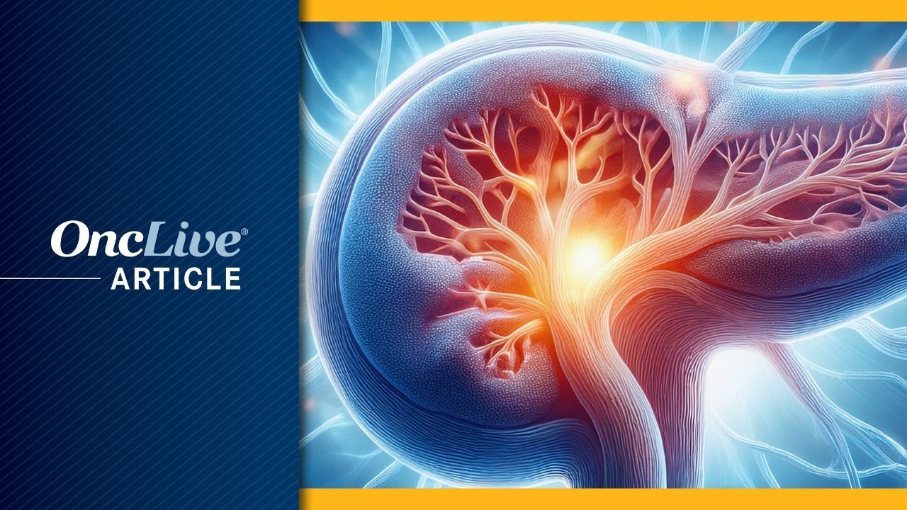 Pancreatic Ductal Adenocarcinoma |   Image by Ashling Wahner and MJH Life Sciences Using AI