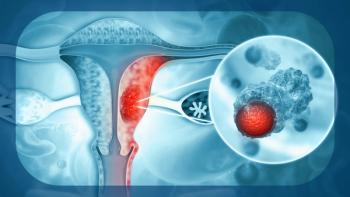 Endometrial Cancer | Image Credit: © Crystal Light - stock.adobe.com