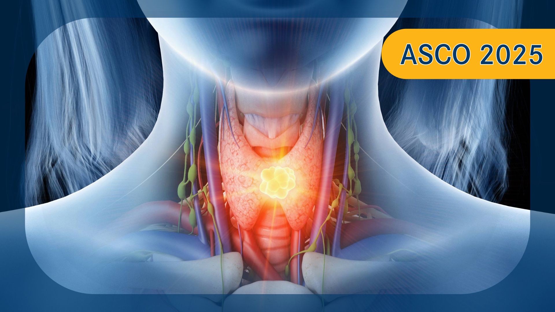Head and Neck Cancer | Image Credit: © Sebastian Kaulitzki - stock.adobe.com