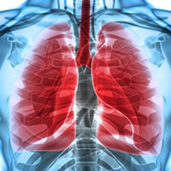 lung cancer