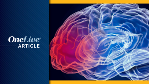 Glioblastoma | Image Credit: © alexlmx - stock.adobe.com