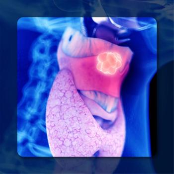 Perioperative pembrolizumab   in HNSCC | Image Credit:   © Sebastian Kaulitzki – stock.adobe.com