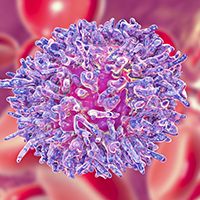 Chronic lymphocytic leukemia