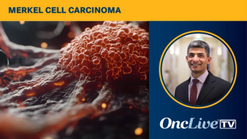 Avelumab in Merkel Cell Carcinoma | Image Credit: © v3 - Pter - stock.adobe.com