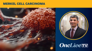Avelumab in Merkel Cell Carcinoma | Image Credit: © v3 - Pter - stock.adobe.com